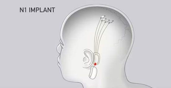 Featured image for “neurolink: διαγώνια περιδιάβαση στον μεταανθρωπισμό…”