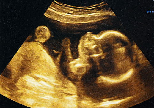 Featured image for “digital «μίνι μήτρα»”